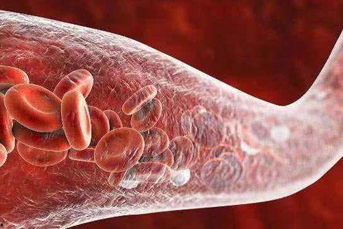 血液淤堵可以吃猪瓜吗,缓解血液淤堵困扰 第2张 血液淤堵可以吃猪瓜吗,缓解血液淤堵困扰 第2张