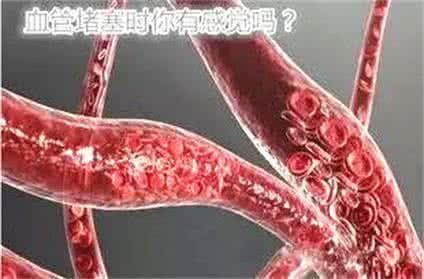 血液淤堵可以吃猪瓜吗,缓解血液淤堵困扰 第3张 血液淤堵可以吃猪瓜吗,缓解血液淤堵困扰 第3张